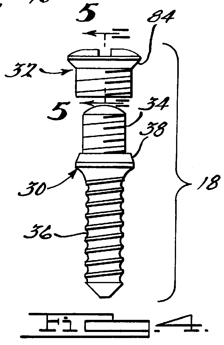 Method and apparatus for mandibular osteosynthesis