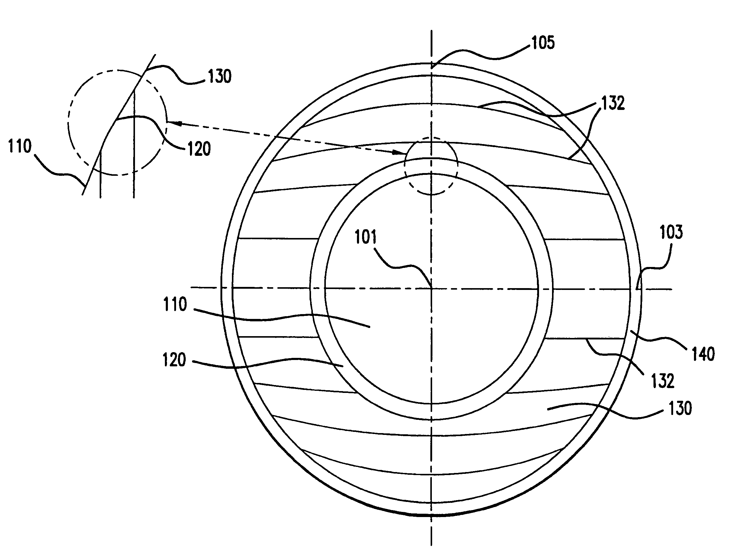 Contact lenses