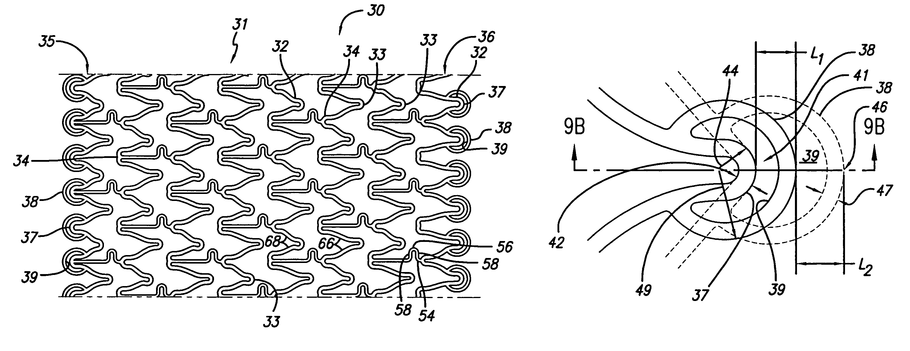 Intravascular stent with extendible end rings