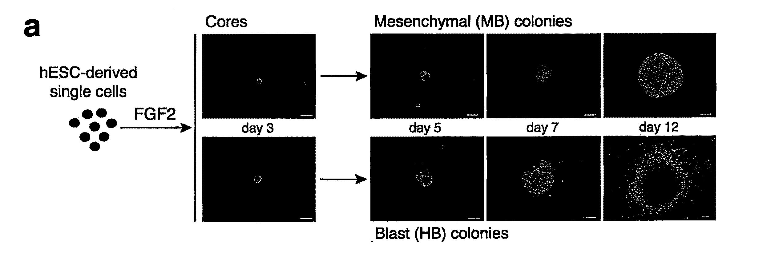 Generation of Clonal Mesenchymal Progenitors and Mesenchymal Stem Cell Lines Under Serum-Free Conditions