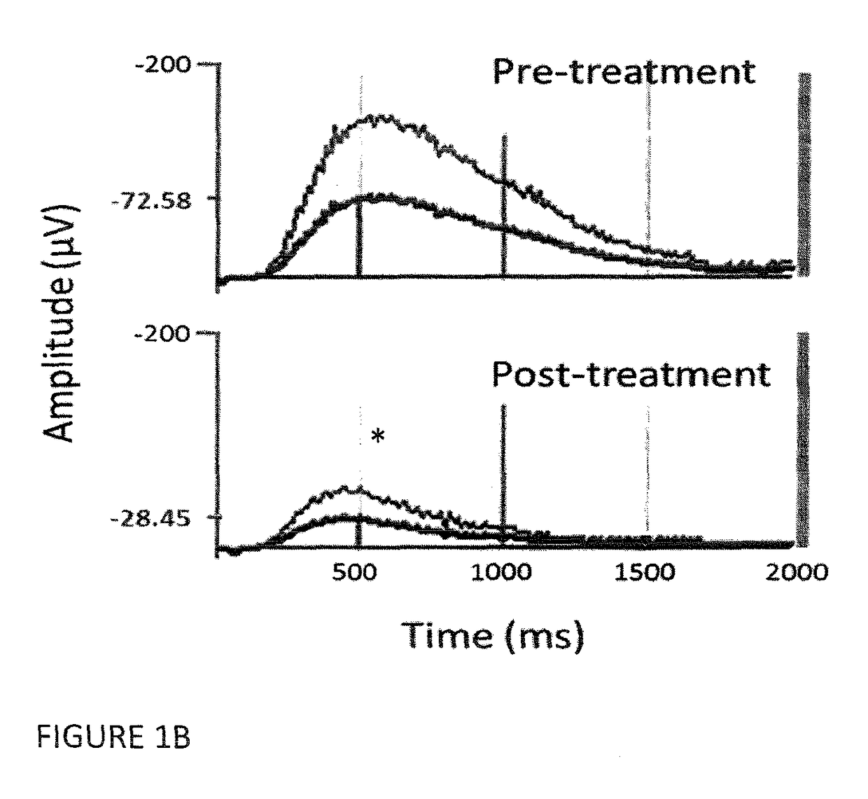 Autoimmune-induced glutamatergic receptor dysfunction methods and treatments