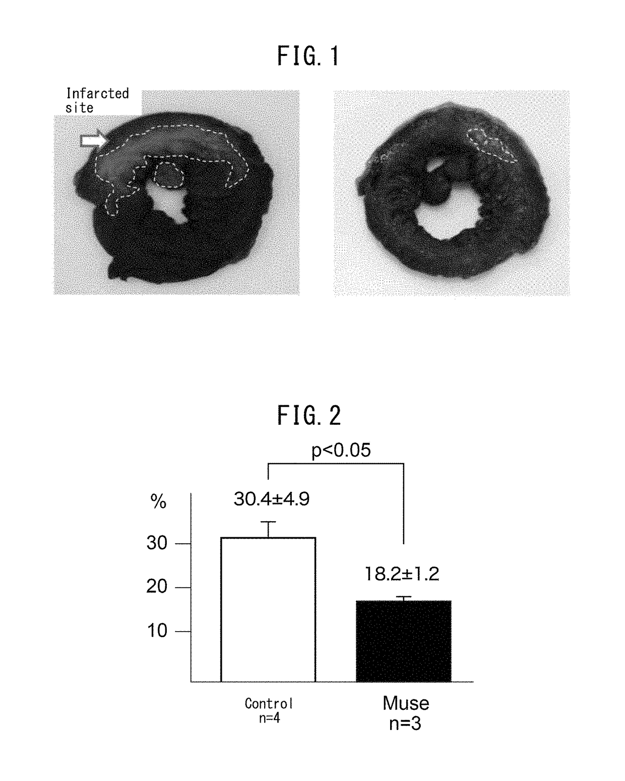 Pluripotent stem cell that induces repair and regeneration after myocardial infarction