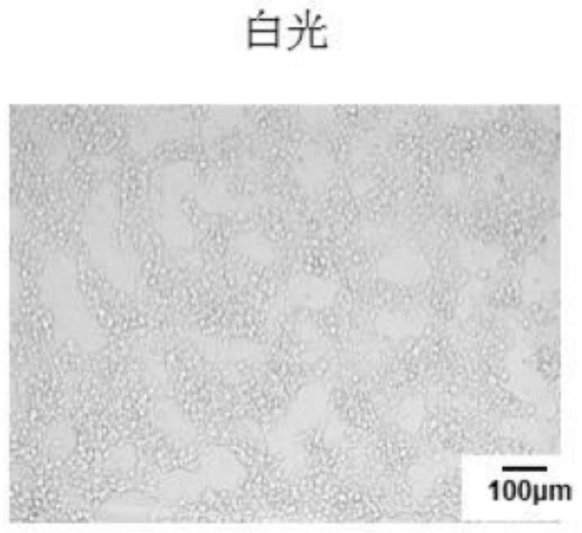 A kind of brain targeting exosome, its preparation method and application