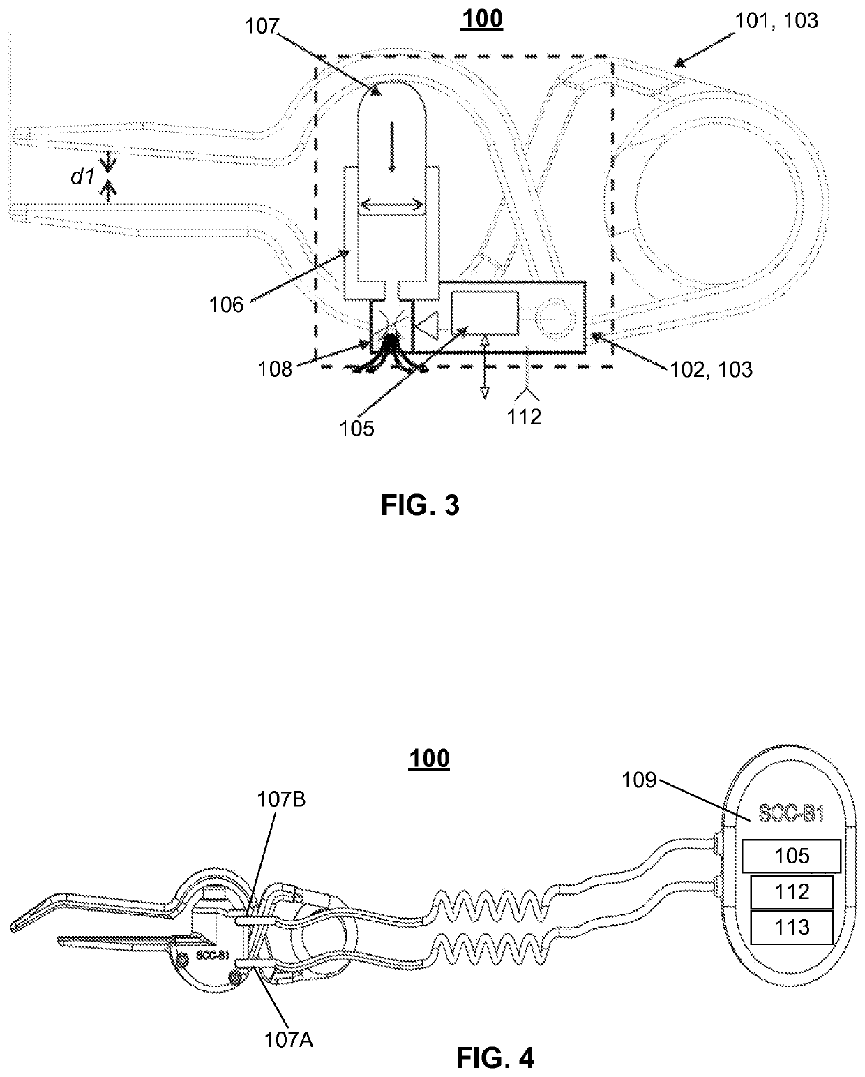 A device for applying external pressure on a surface of an anatomical object