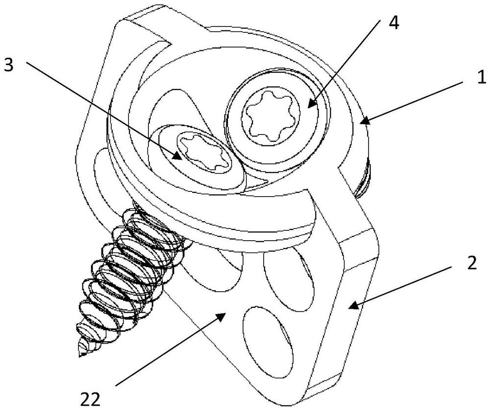 Vertebral plate replantation fixing device capable of grafting bone