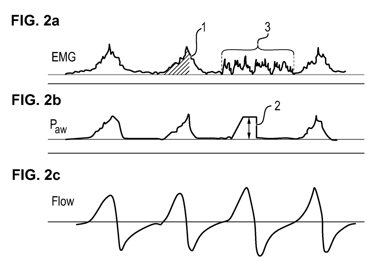 Device for the pressure-supported or pressure-controlled ventilation of a patient with reduced spontaneous breathing