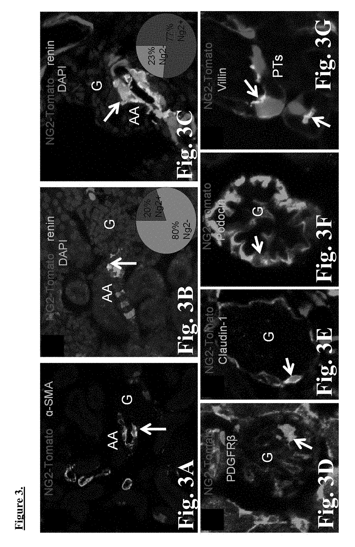 Targeting macula densa cells as a new therapeutic approach for kidney disease