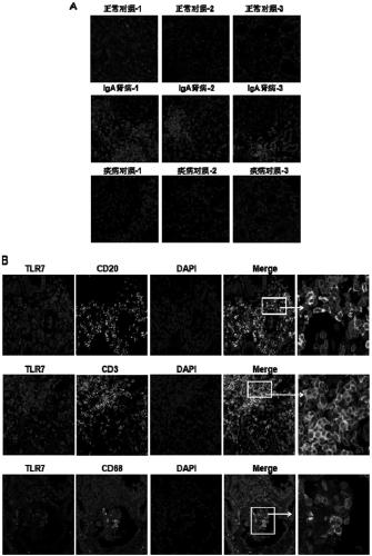 Application of TLR7 and TLR8 as prophylactic and therapeutic targets for IgA nephropathy and inhibitors of TLR7 and their use