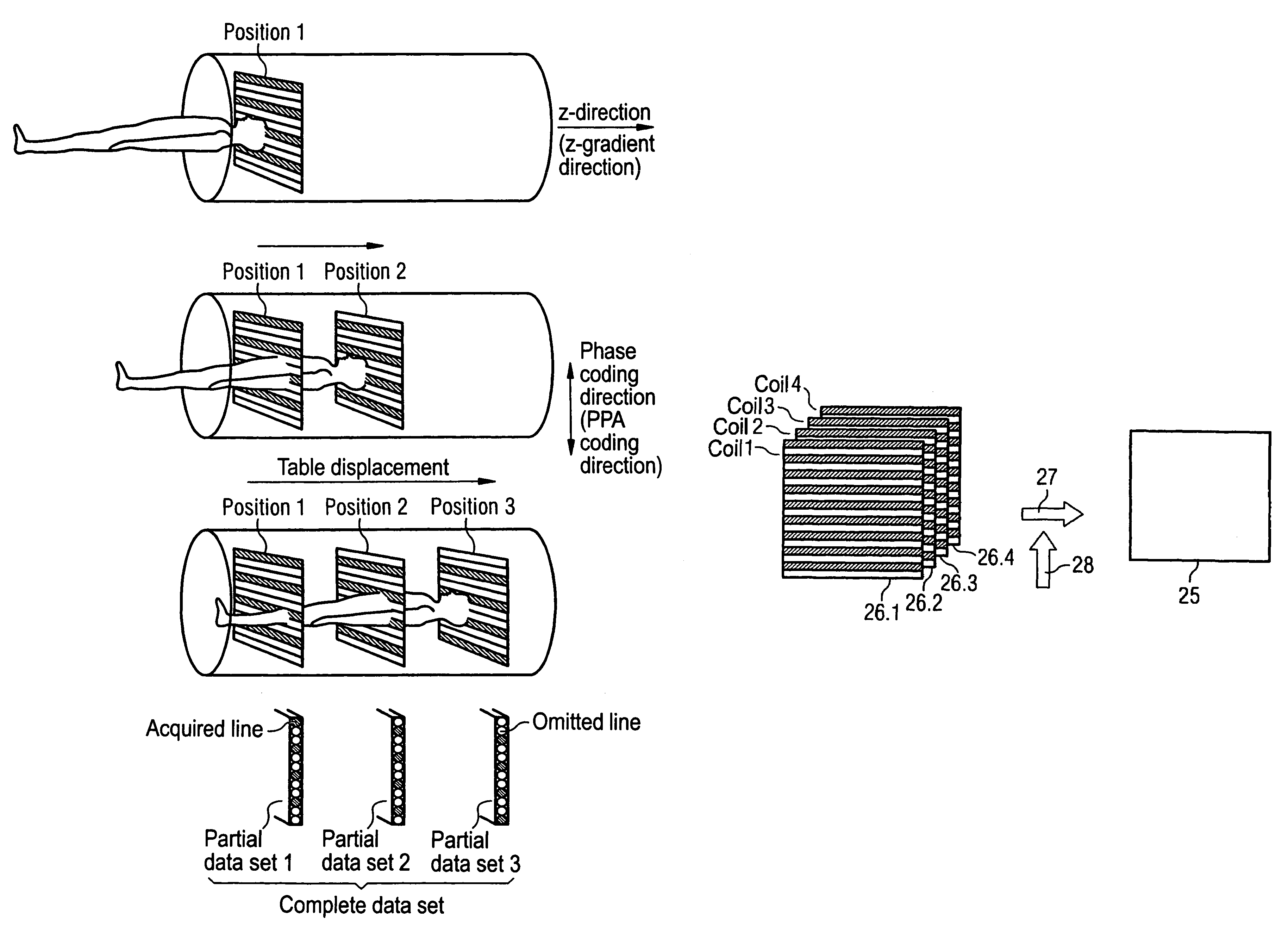 MRT imaging on the basis of conventional PPA reconstruction methods