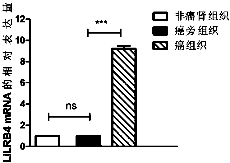 Biological marker related with clear cell renal cell carcinoma and application thereof