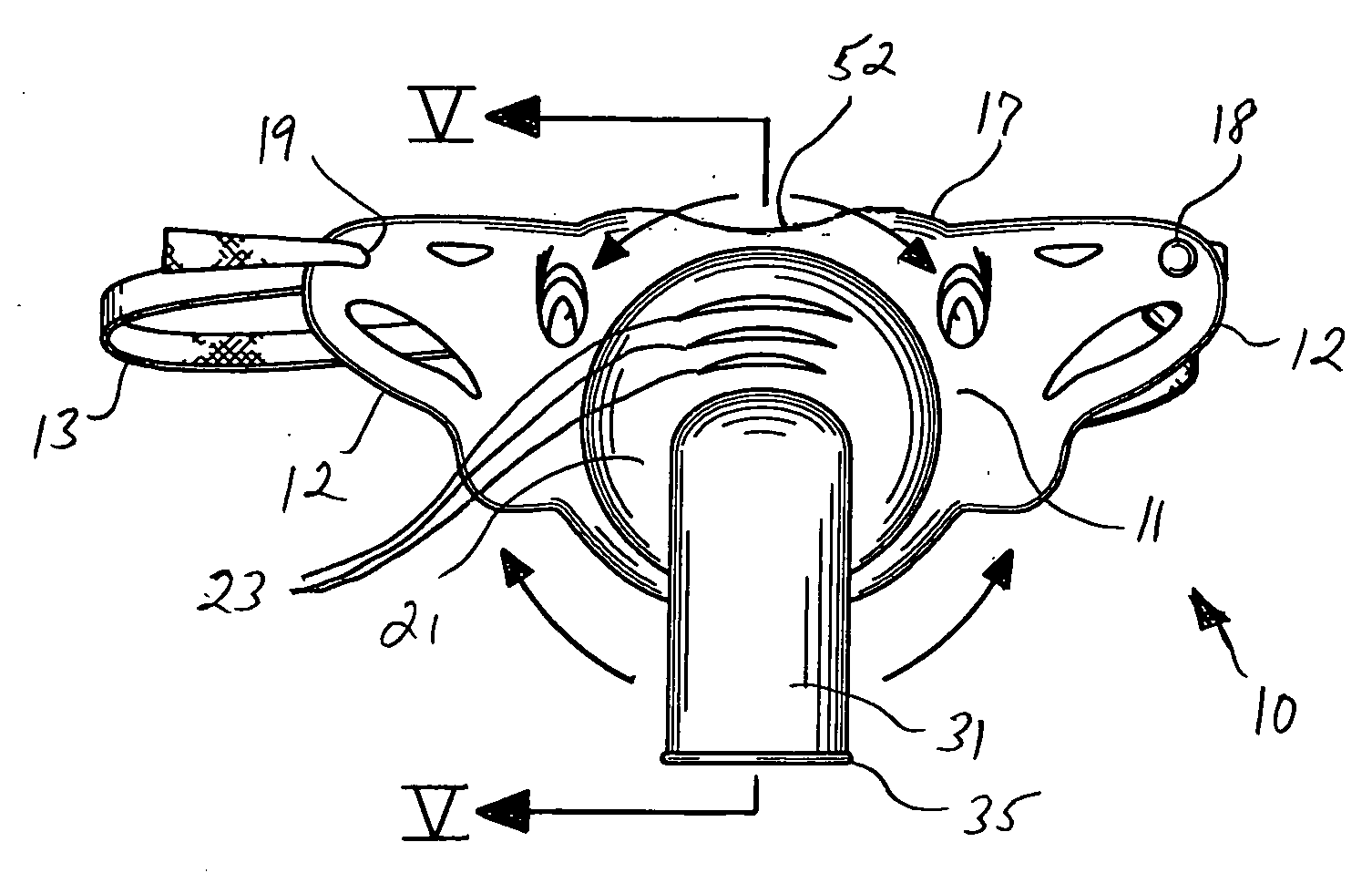 Pediatric tracheostomy mask