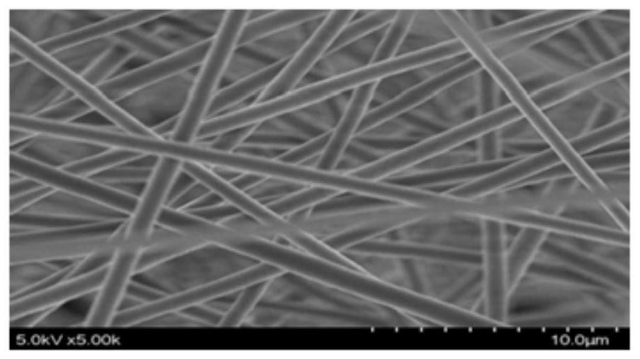 Preparation method of antibacterial wound dressing capable of promoting healing