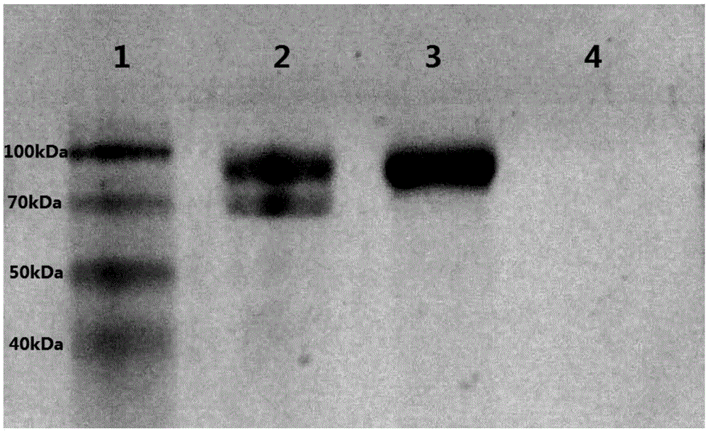 A recombinant Pichia pastoris strain co-expressing exo-inulinase and endonuclease and its construction method and application