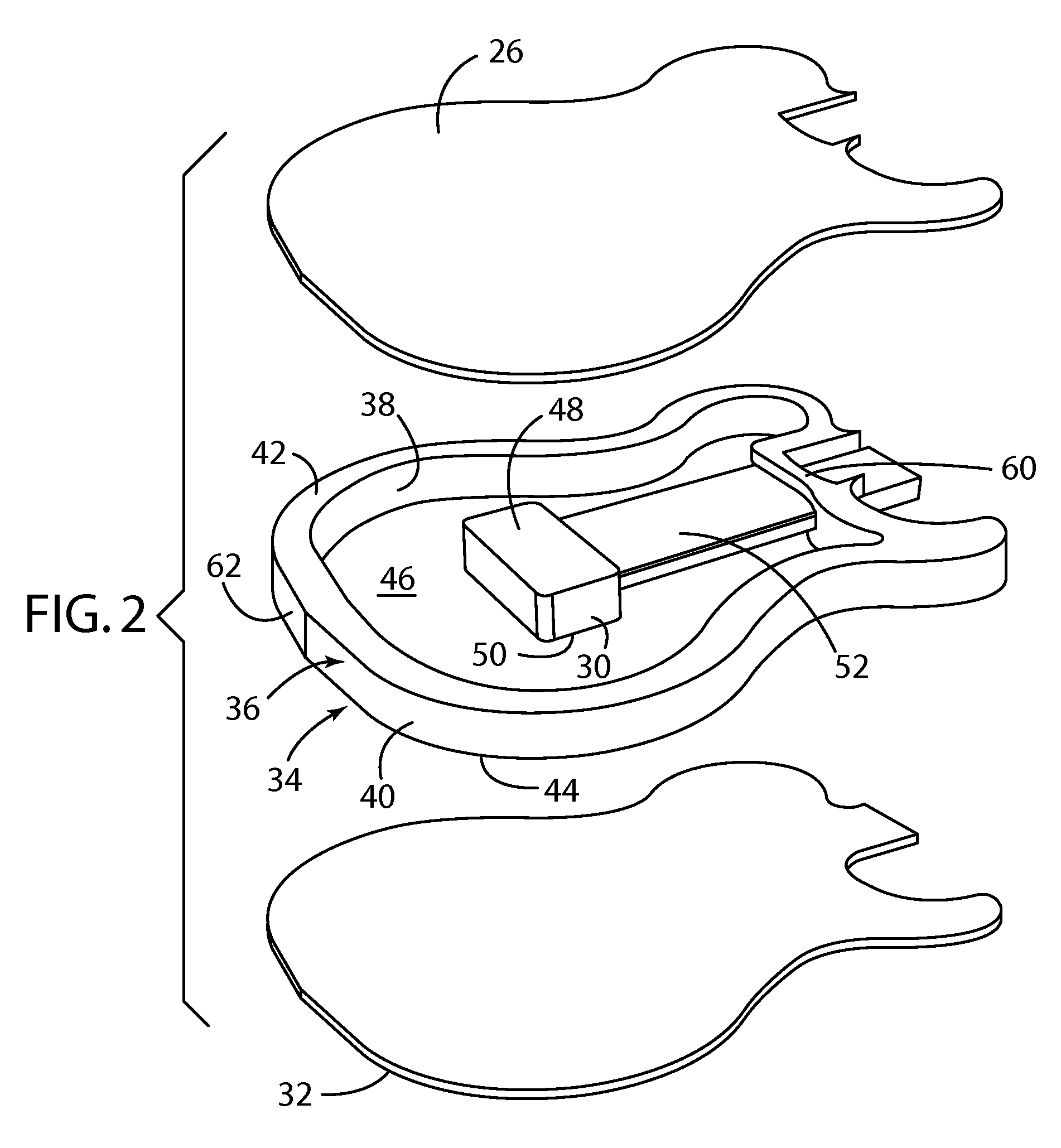 Structure for musical instrument body