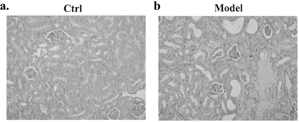 Establishing method of chronic kidney disease angiosteosis experiment model