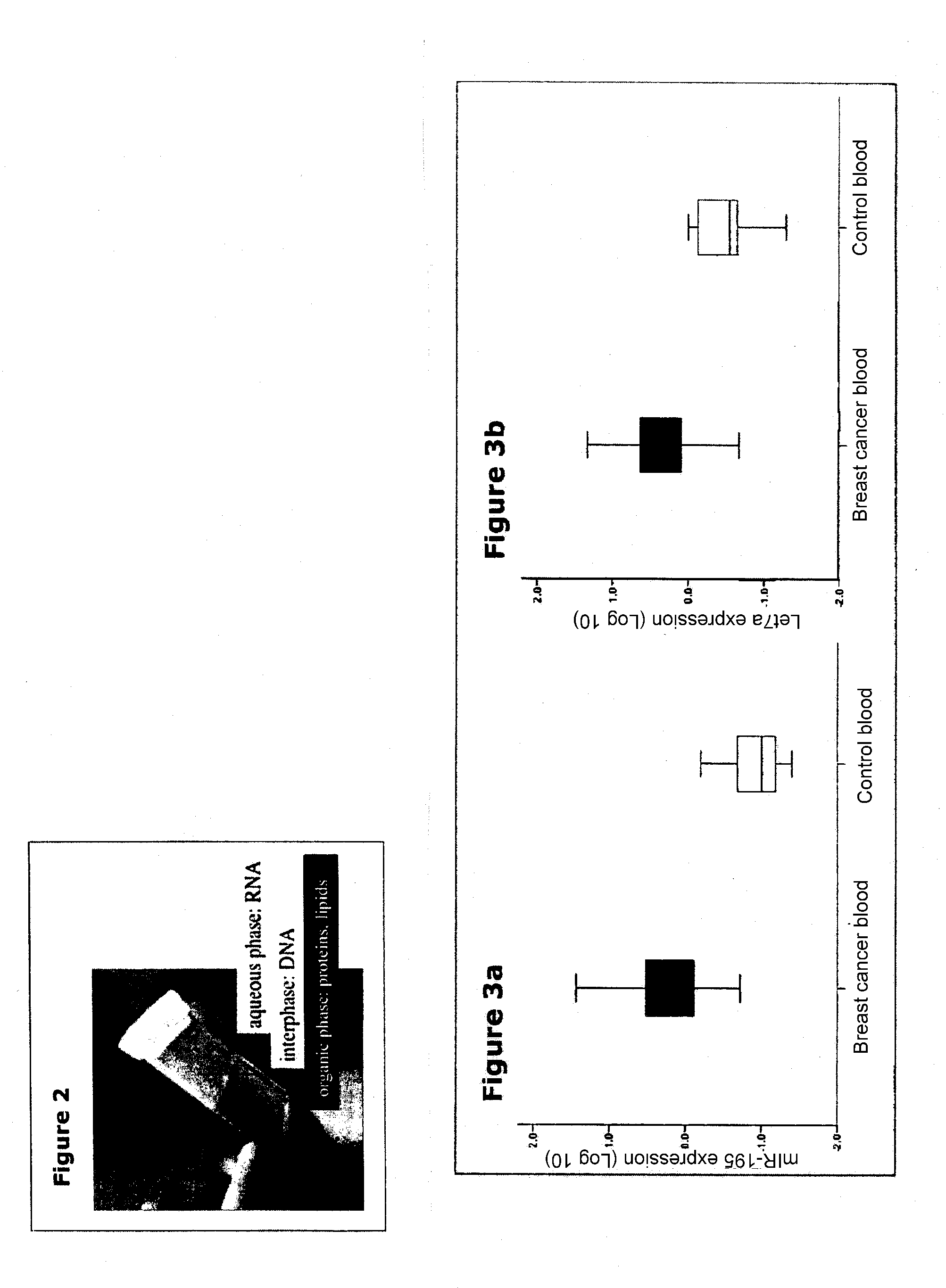 Detection and quantification of microRNAs in the circulation and the use of circulating microRNAs as biomarkers in cancer