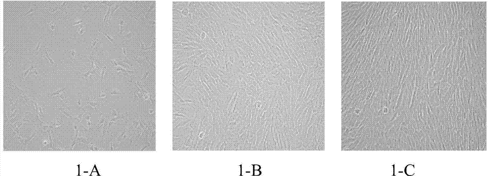 Composite stent material