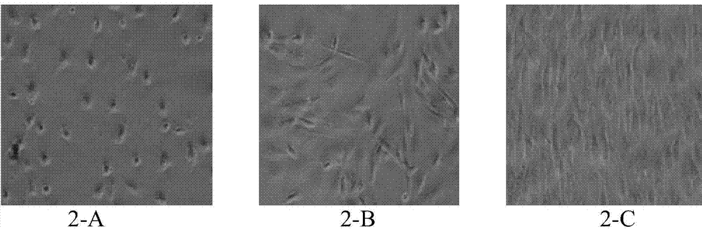 Composite stent material