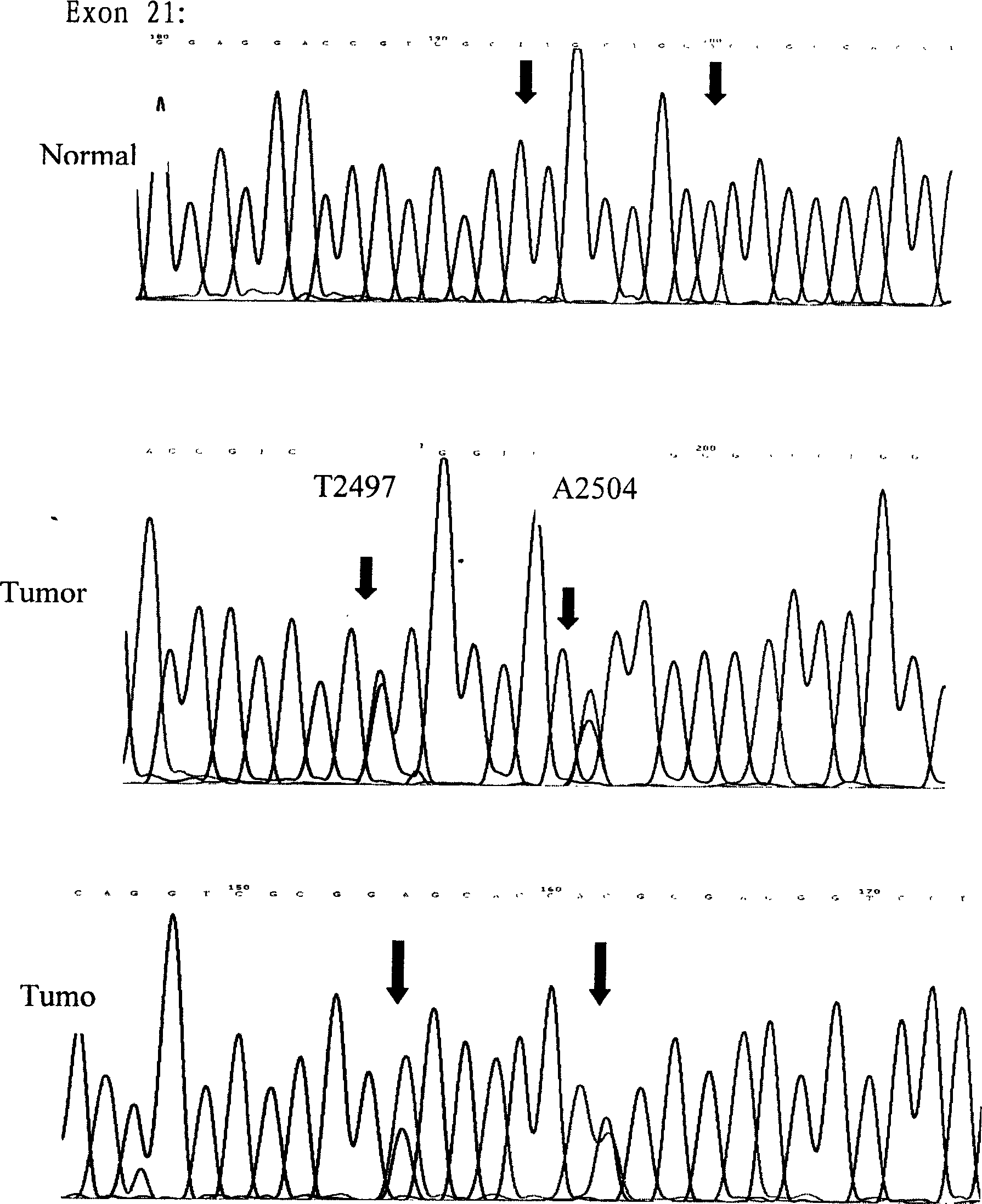 Epidermal growth factor receptor (EGFR)gene sequencing detection method