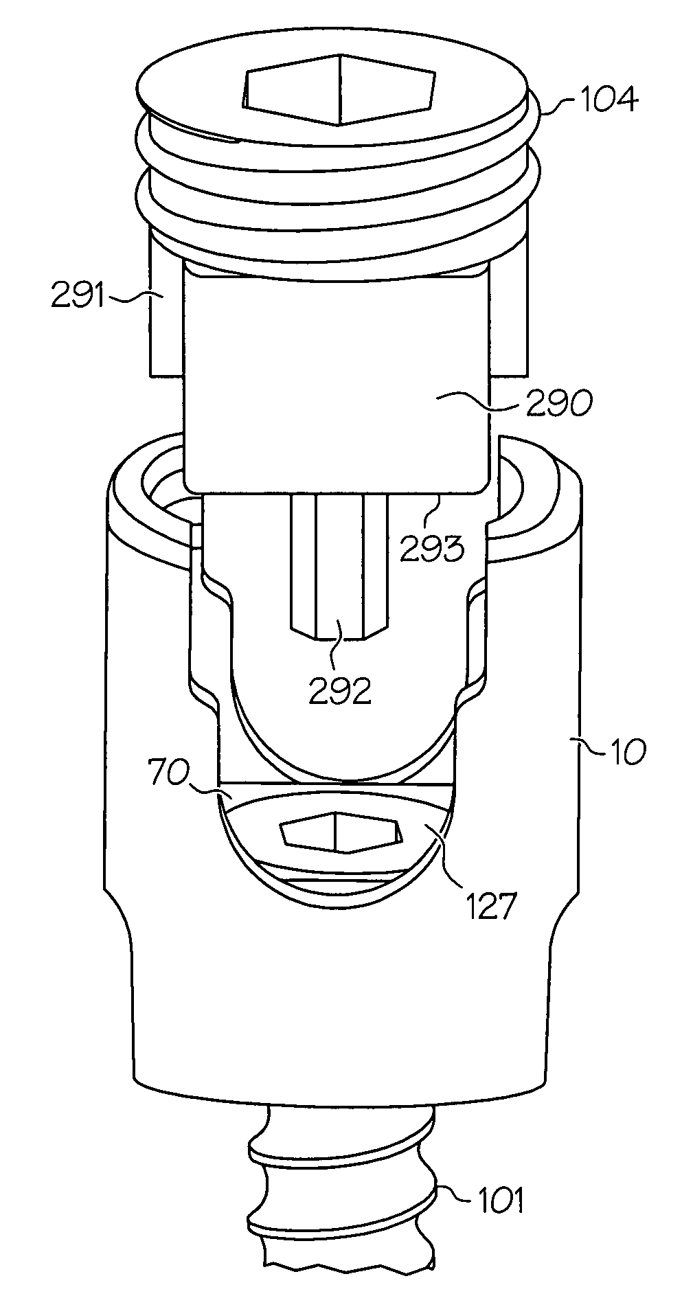 Modular pedicle screw system