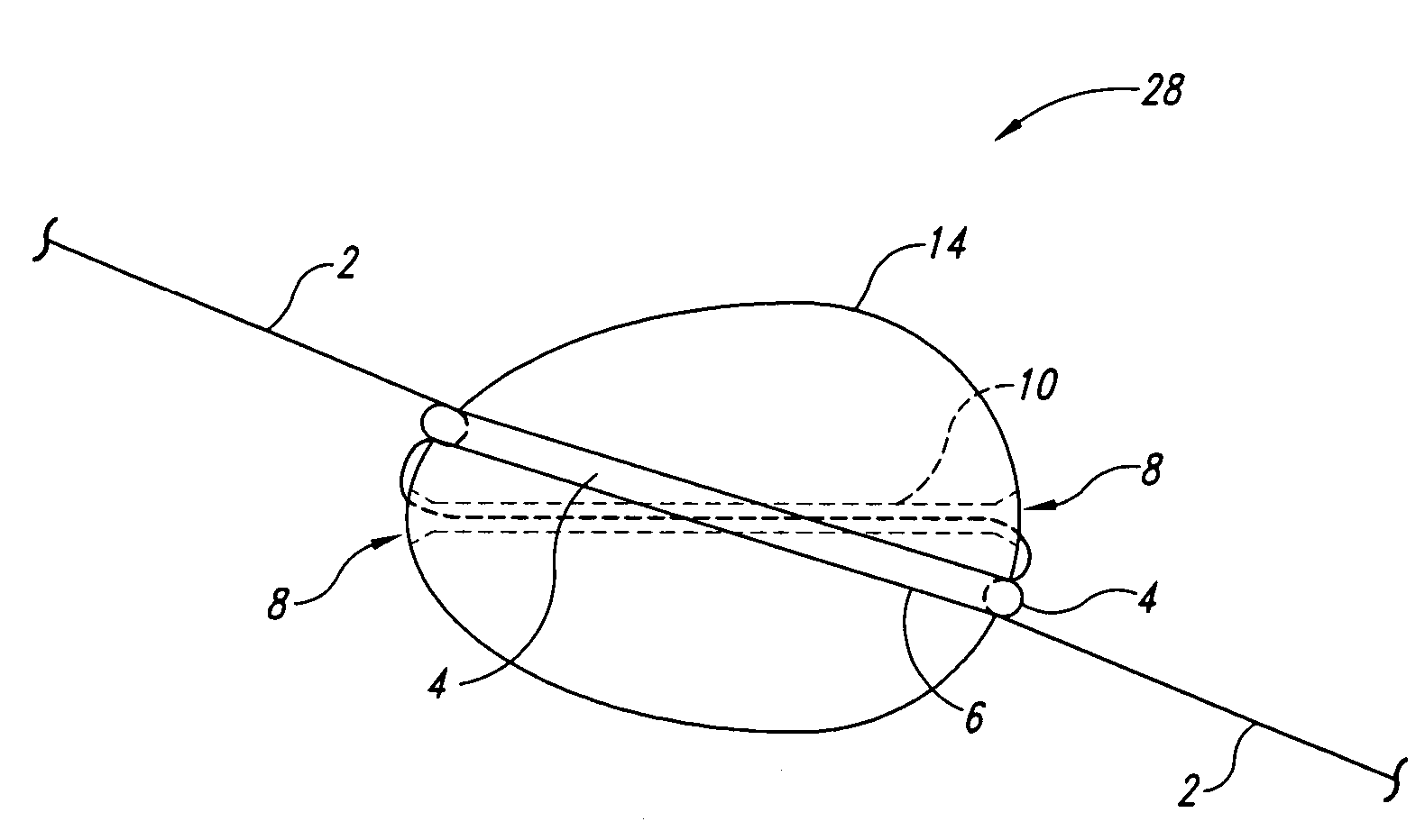 Reversibly disengaging slidable strike indicator, positioning system, and method of using same