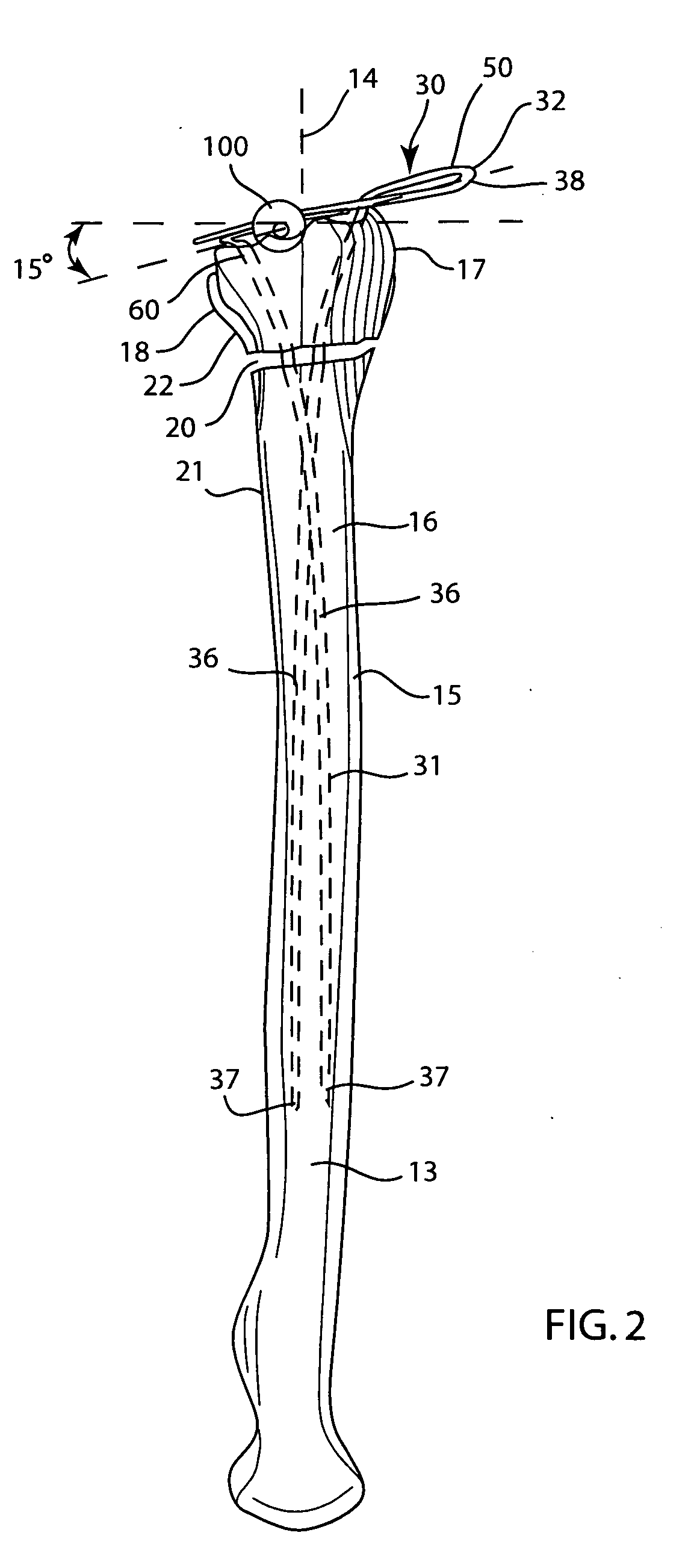 Fixator for a fractured bone