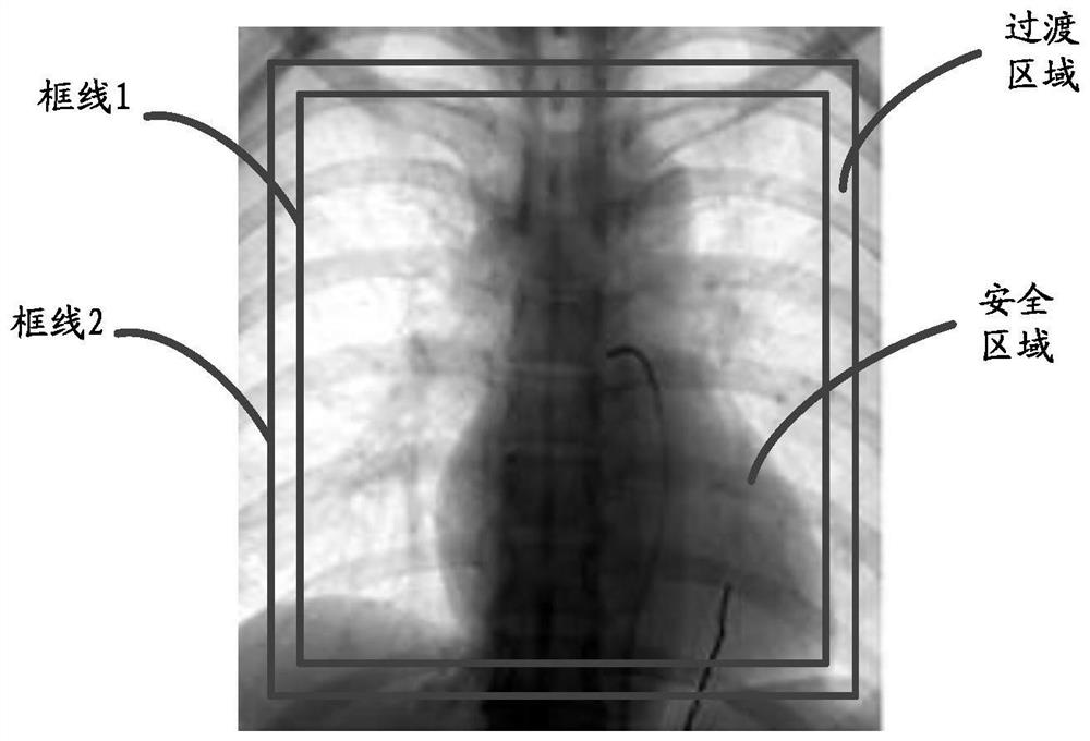 Angiographic method, device, system, equipment and storage medium