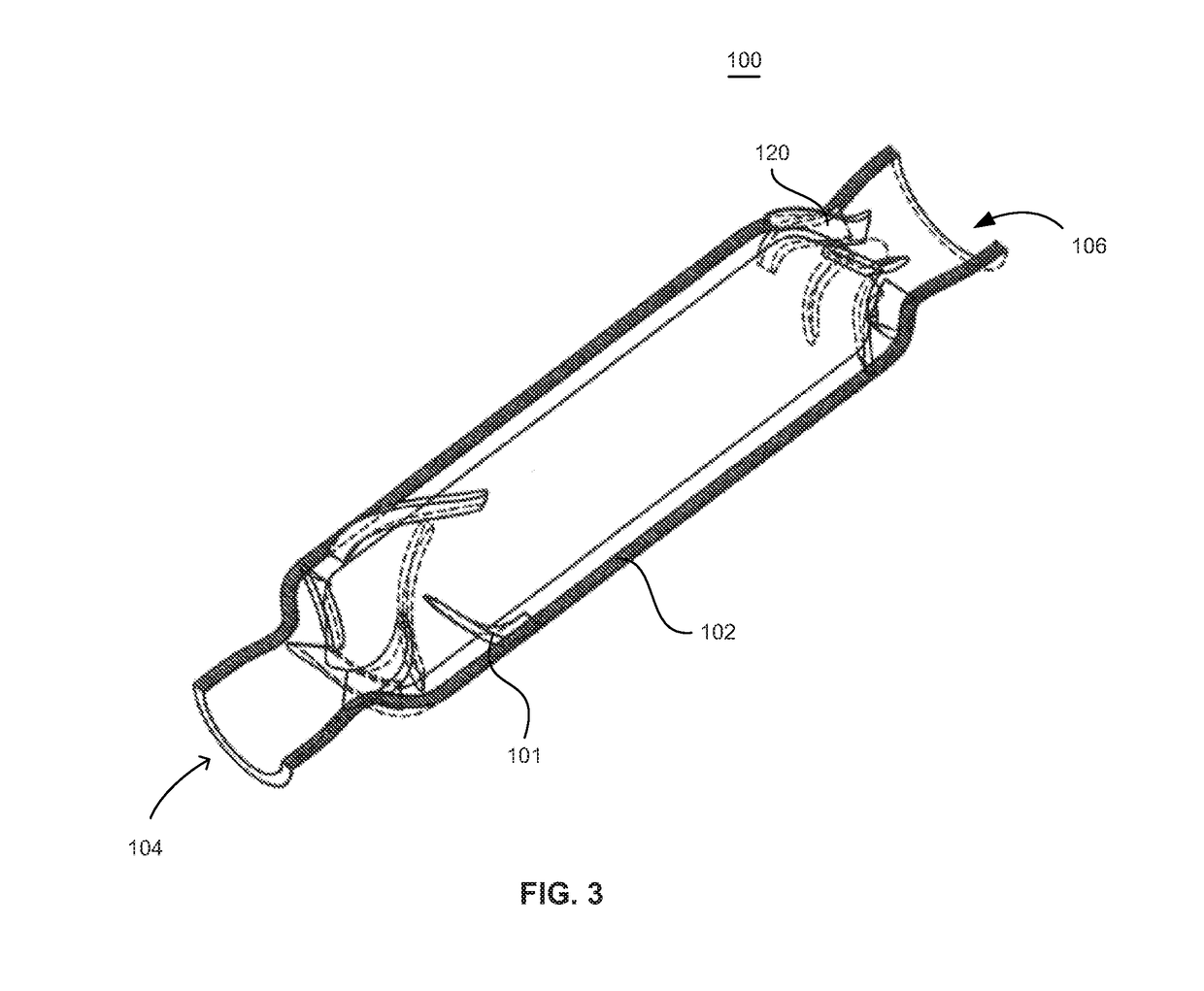 Blood pump with separate mixed-flow and axial-flow impeller stages and multi-stage stators