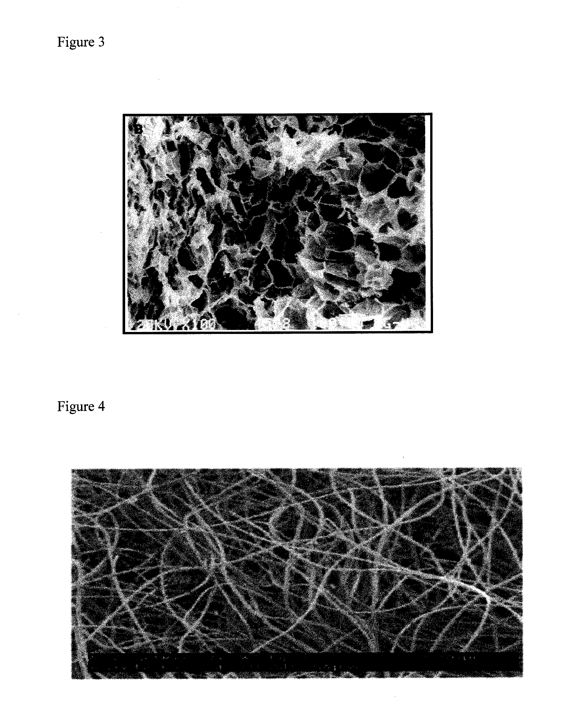 Nanofibrous scaffold comprising immobilized cells