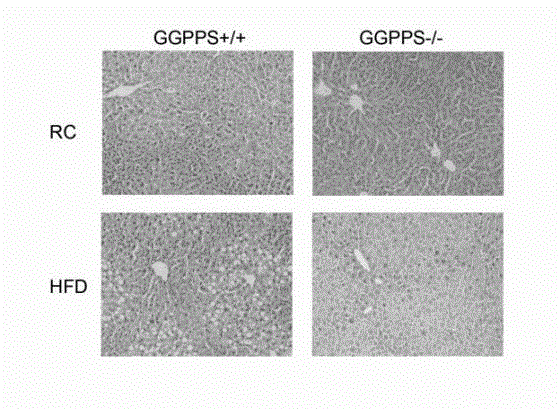 Application of GGPPS genes in preparation of medicines for treating non-alcoholic fatty liver disease