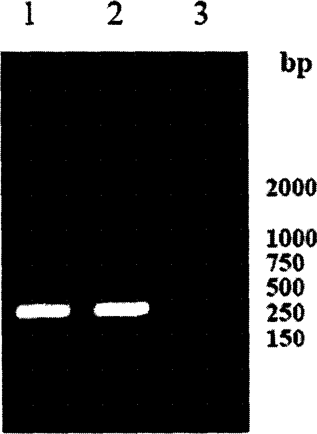 Eukaryon expression of coli heat-sensitive toxin B subunit