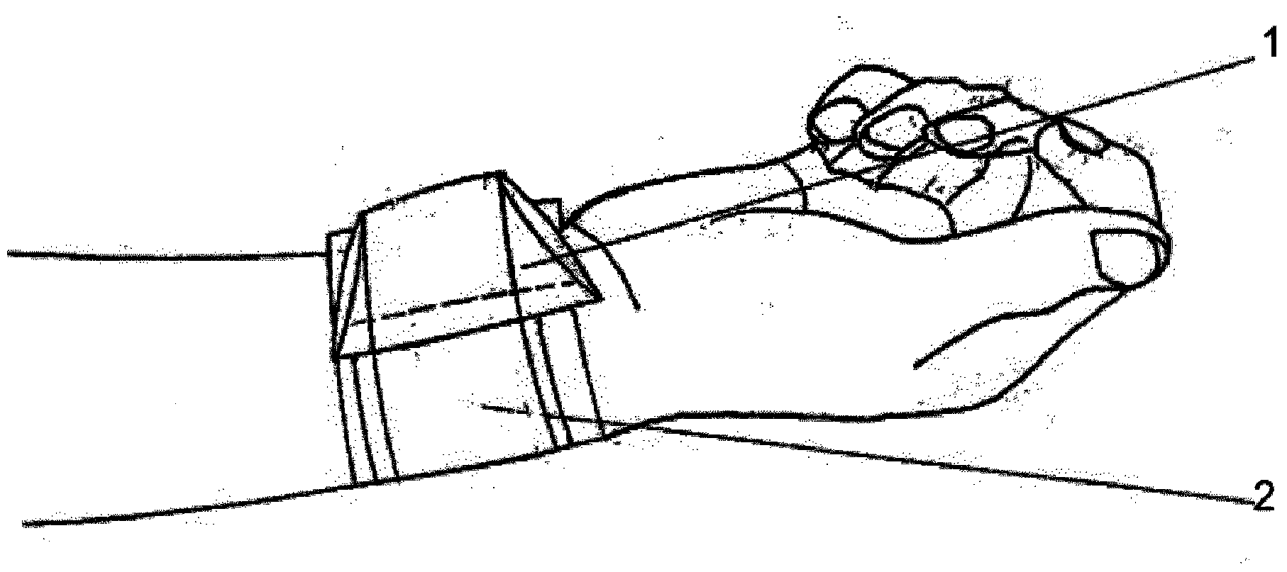 Medical device and methods for blood vessel compression