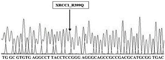 Primer and method for detecting XRCC1 gene polymorphism