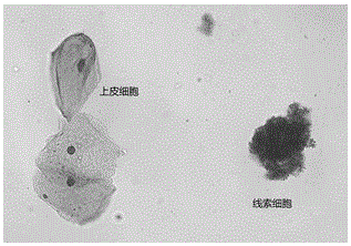 Vaginal secretion staining fluid, and preparation method and staining method thereof