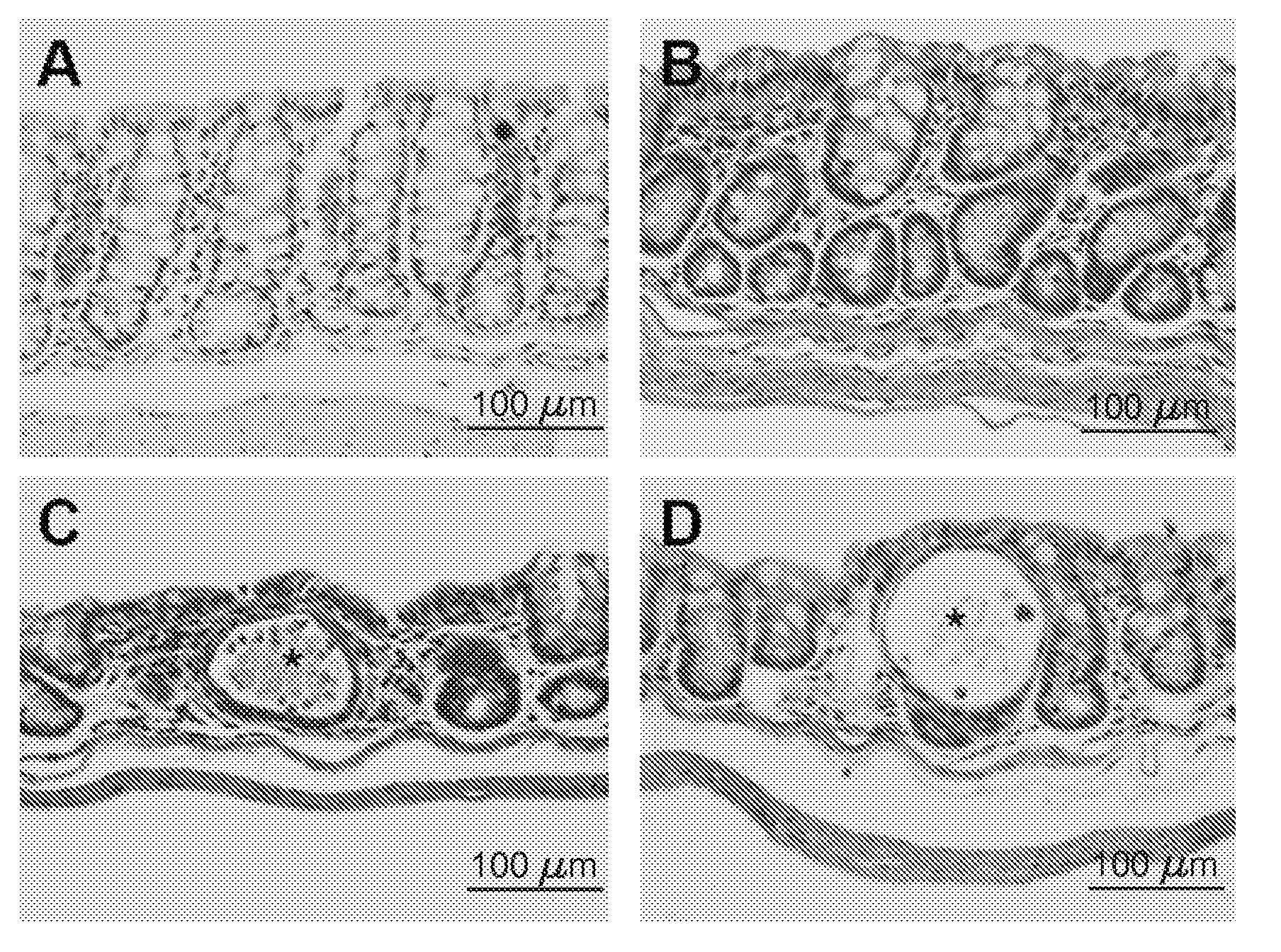 Cancer Chemoprevention Strategy Based on Loss of Imprinting of IGF2