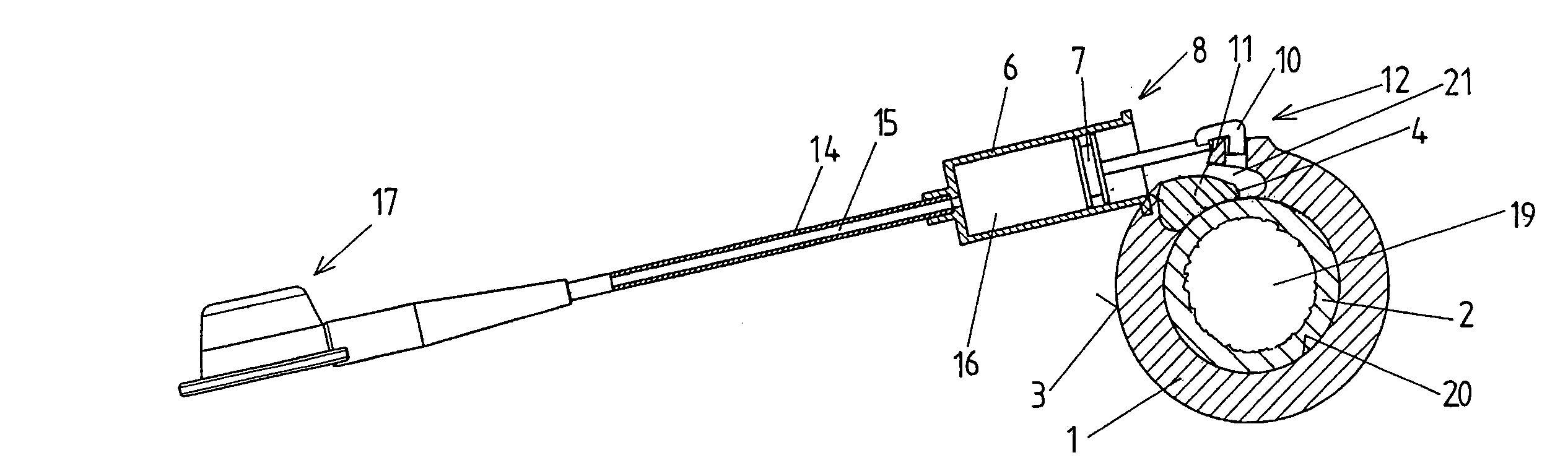 Device for generating an artificial constriction in the gastrointestinal tract