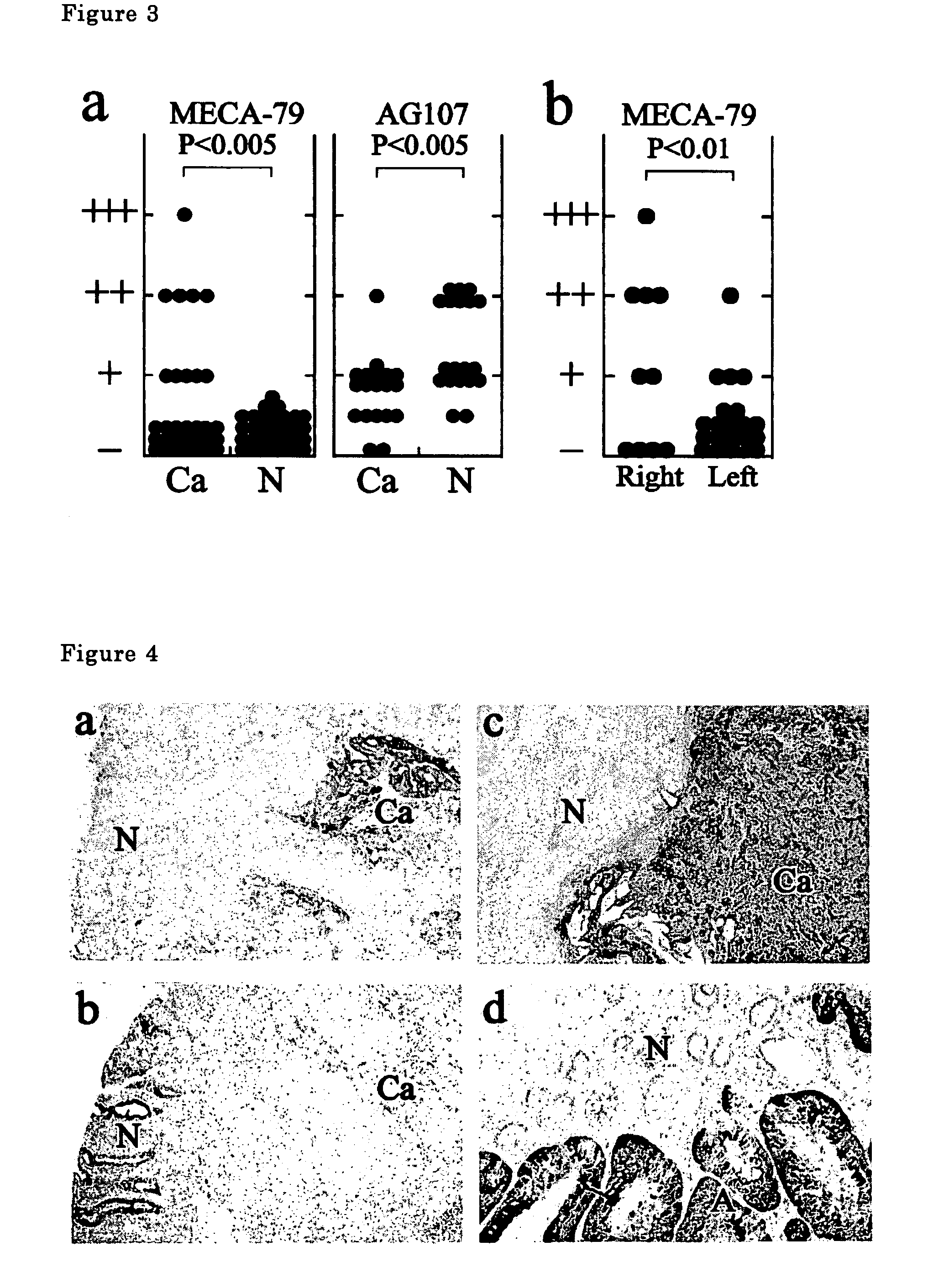 Method of examining colon cancer and colon adenoma