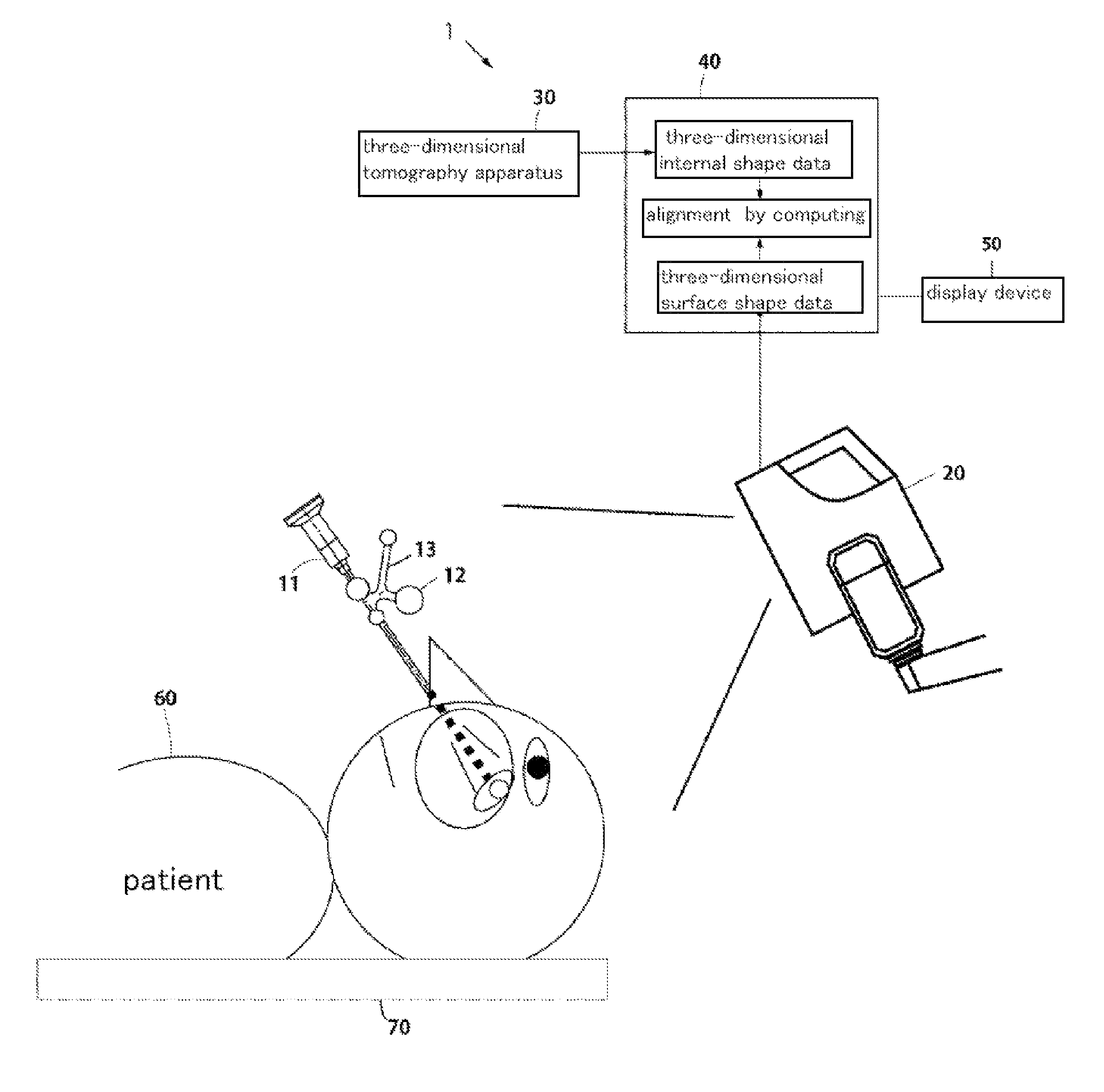 Surgery assistance system