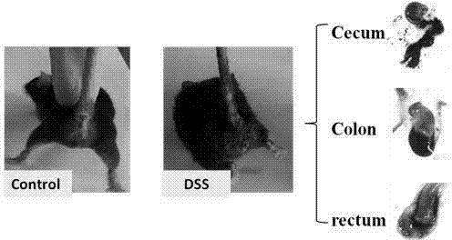 Comprehensive model for protecting mice and curing mice macrophage system UC (Ulcerative Colitis) by C-BF (Cathelicidin-BF)