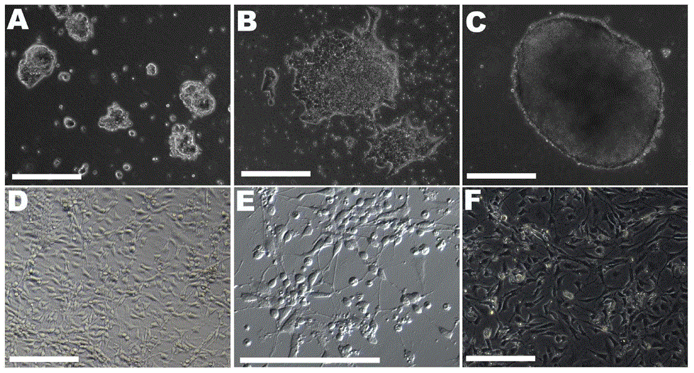 Method for quickly, directly and directionally inducing differentiation from mouse embryonic stem cells to neuroepithelial cells