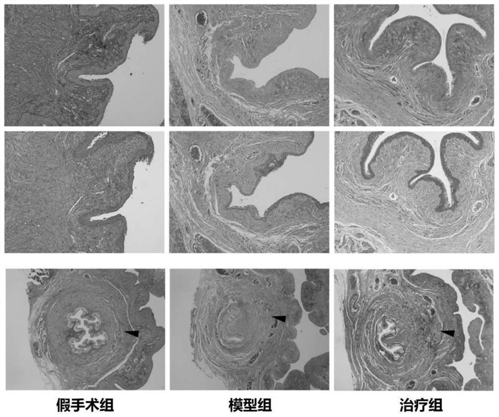 Application of recombinant I-type humanized collagen in pelvic floor repair