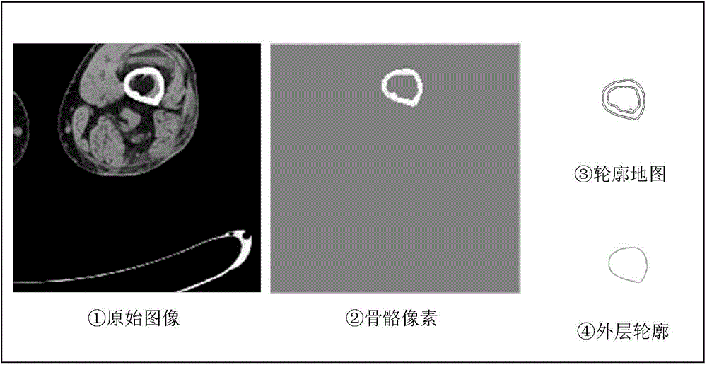 Priori-knowledge-based reconstruction method of closed skeleton contour in medical fault image