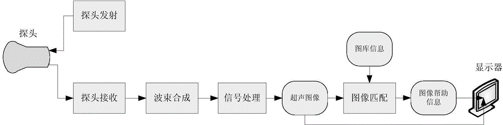 Ultrasonic auxiliary scanning method and ultrasonic auxiliary scanning system