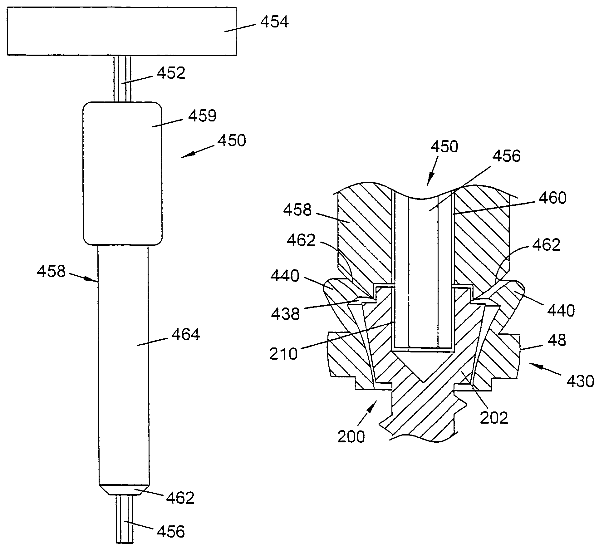 System and method for stabilizing the human spine with a bone plate