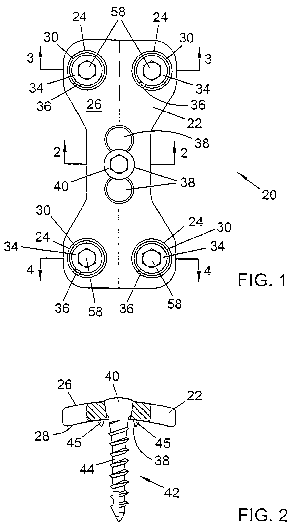 System and method for stabilizing the human spine with a bone plate