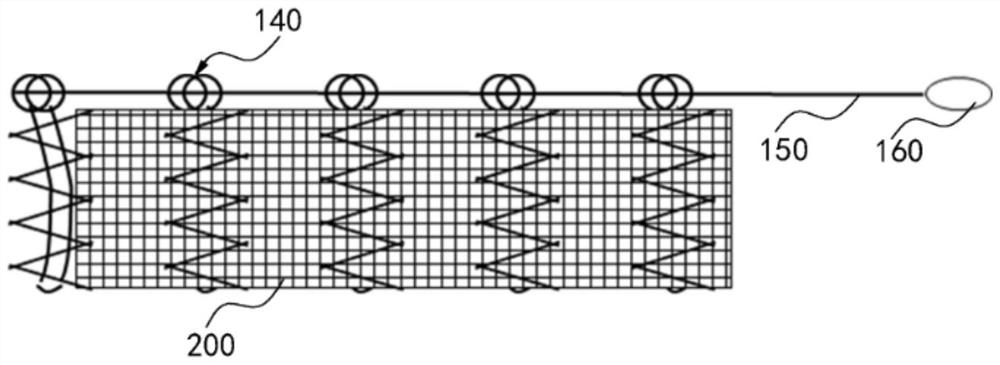 Stent restraining system