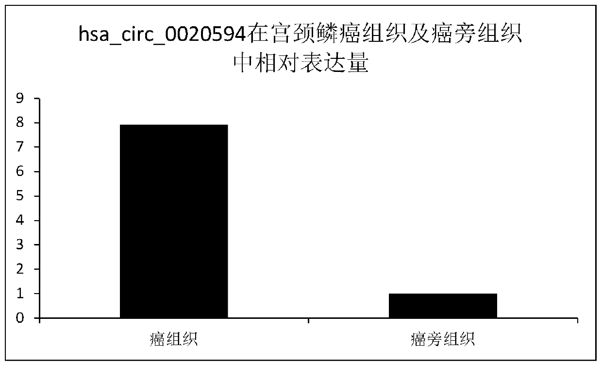 A molecular marker of cervical cancer and its application