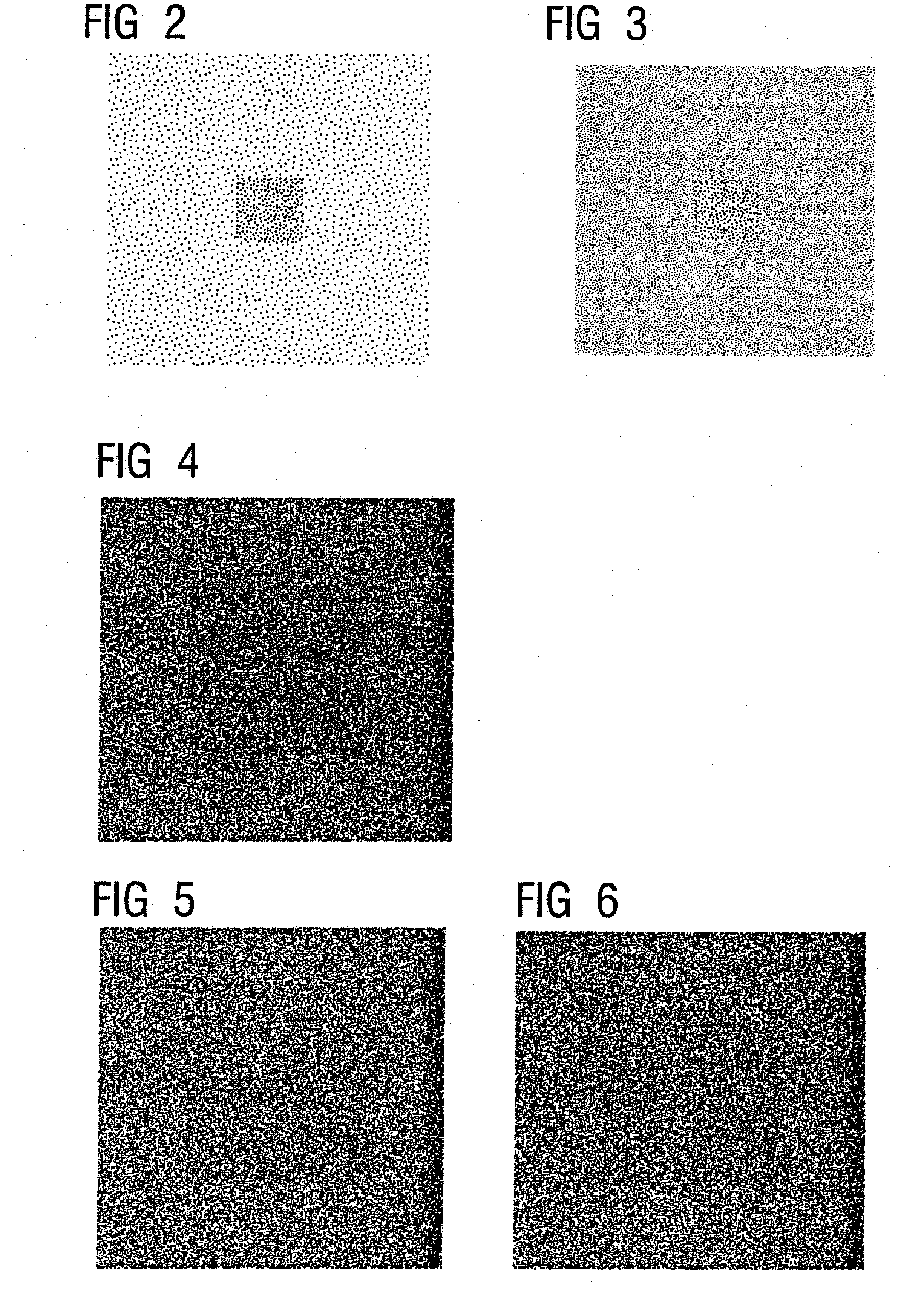 Scatter radiation correction in radiography and computed tomography employing flat panel detector