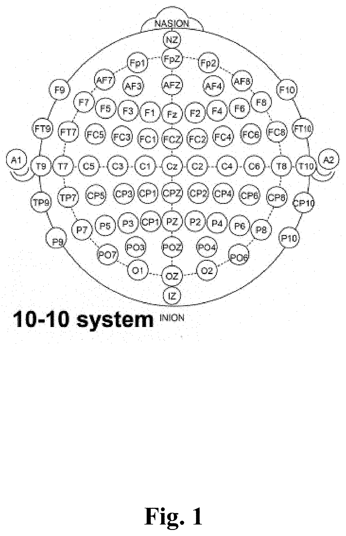 On-ear electroencephalographic monitoring device