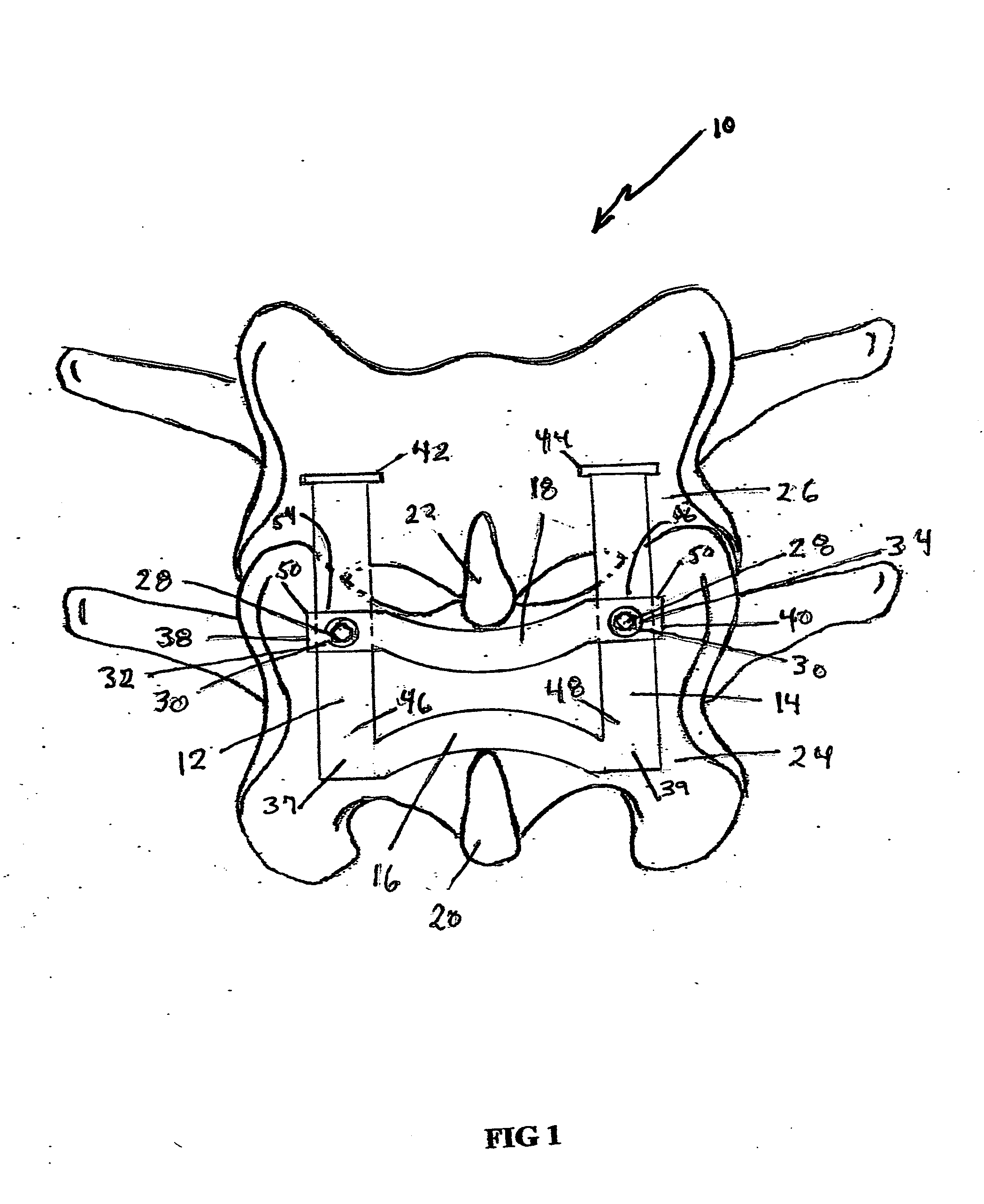 Adjustable spinous process spacer device and method of treating spinal stenosis